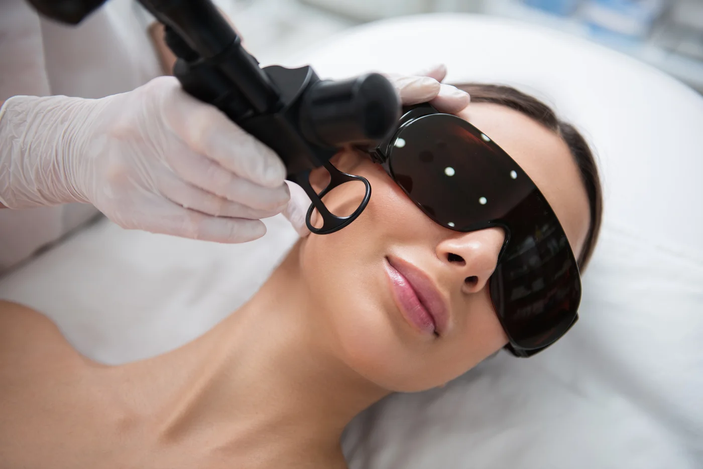 Fractional laser resurfacing treatment illustration