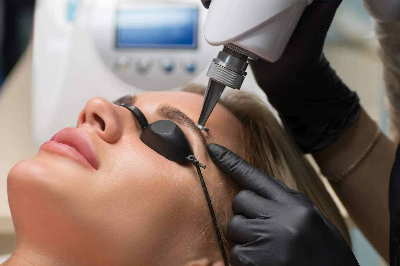 Permanent makeup removal treatment illustration